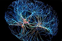 عصب هوش طبیعی